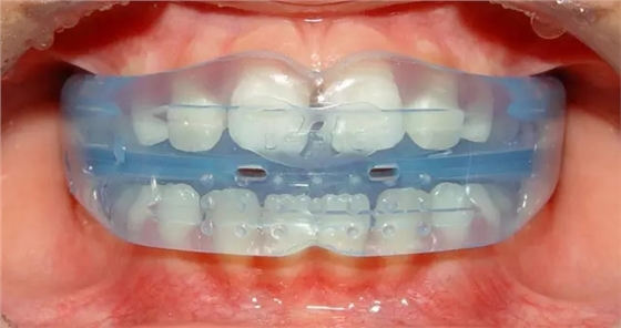 640.webp (8).jpg 640.webp (8).jpg