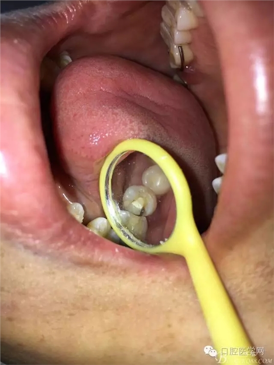 640.webp (1).jpg 640.webp (1).jpg