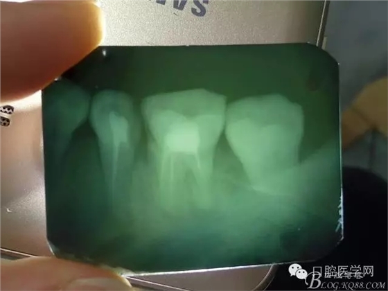 640.webp (2).jpg 640.webp (2).jpg