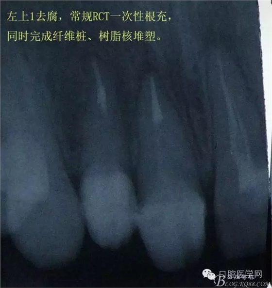 640.webp (2).jpg 640.webp (2).jpg