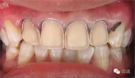 640.webp.jpg 640.webp.jpg