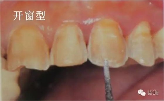 640.webp (12).jpg 640.webp (12).jpg