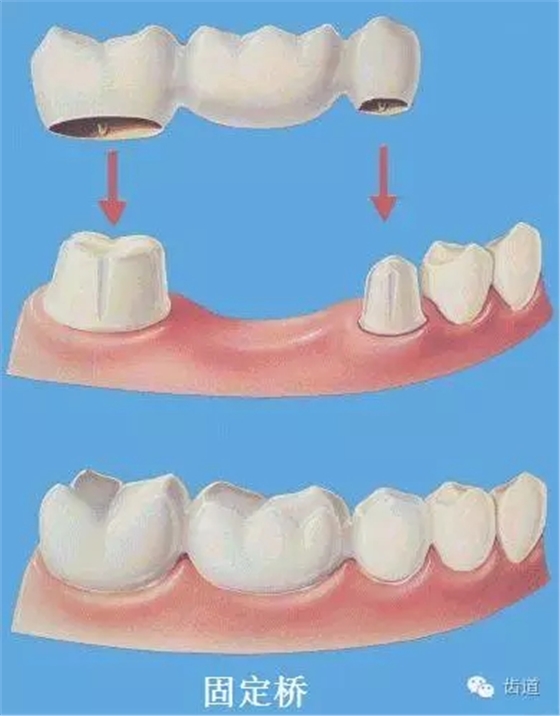 640.webp (11).jpg 640.webp (11).jpg