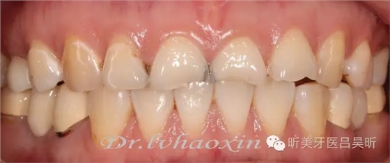 640.webp.jpg 640.webp.jpg