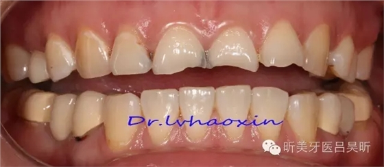 640.webp (1).jpg 640.webp (1).jpg