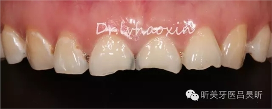 640.webp (2).jpg 640.webp (2).jpg