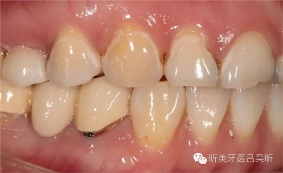 640.webp (3).jpg 640.webp (3).jpg