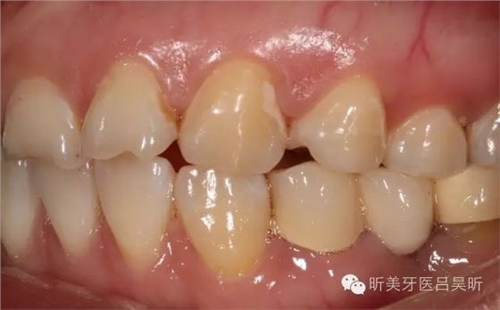 640.webp (4).jpg 640.webp (4).jpg