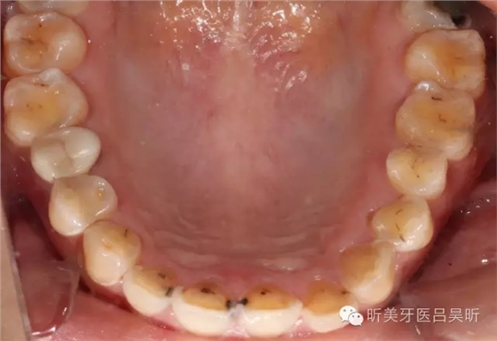 640.webp (5).jpg 640.webp (5).jpg