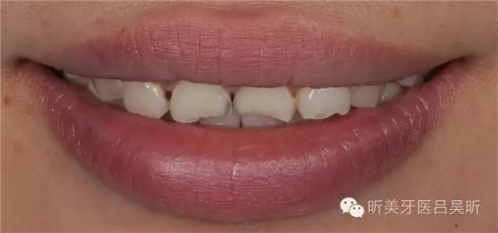 640.webp (6).jpg 640.webp (6).jpg