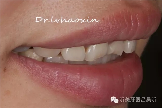 640.webp (7).jpg 640.webp (7).jpg