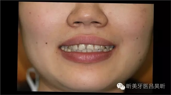 640.webp (8).jpg 640.webp (8).jpg