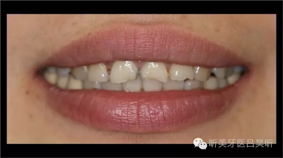 640.webp (9).jpg 640.webp (9).jpg