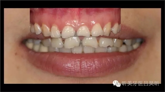 640.webp (10).jpg 640.webp (10).jpg