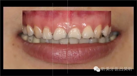 640.webp (11).jpg 640.webp (11).jpg