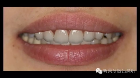 640.webp (18).jpg 640.webp (18).jpg