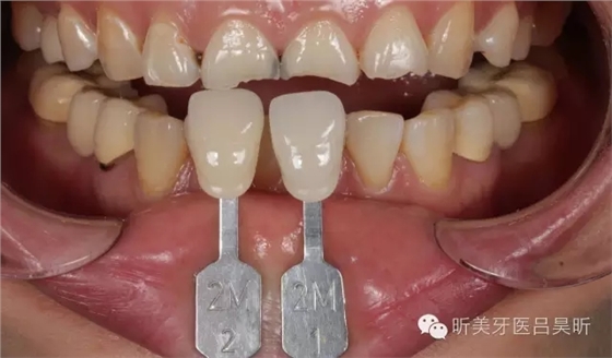 640.webp (26).jpg 640.webp (26).jpg