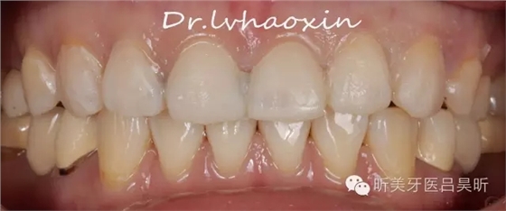 640.webp (33).jpg 640.webp (33).jpg