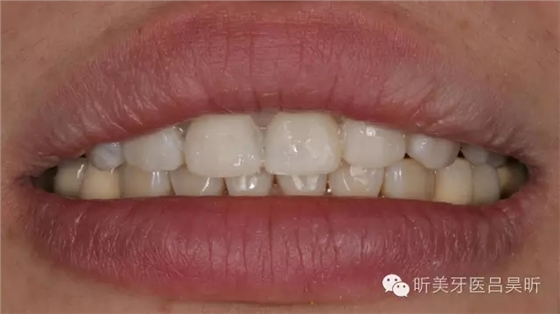 640.webp (34).jpg 640.webp (34).jpg