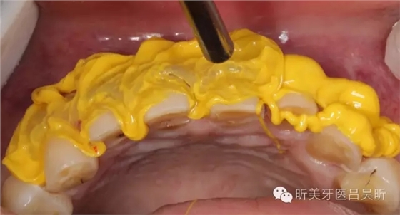 640.webp (48).jpg 640.webp (48).jpg