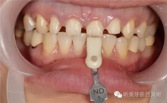 640.webp (49).jpg 640.webp (49).jpg