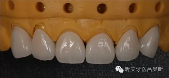 640.webp (58).jpg 640.webp (58).jpg