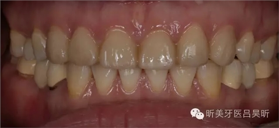 640.webp (60).jpg 640.webp (60).jpg