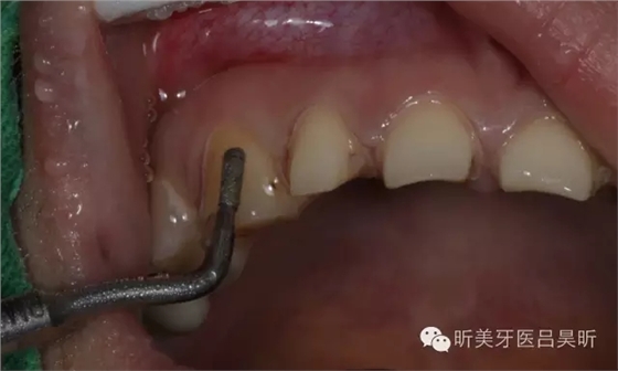 640.webp (62).jpg 640.webp (62).jpg