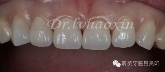 640.webp (63).jpg 640.webp (63).jpg