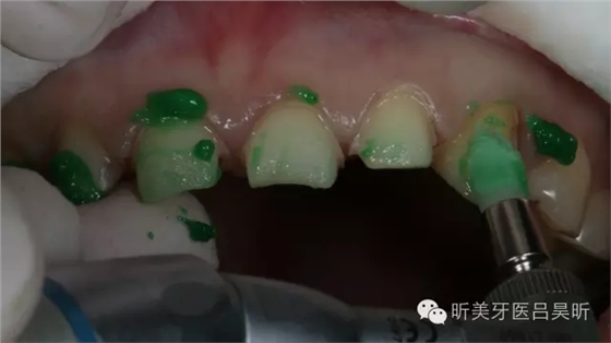 640.webp (64).jpg 640.webp (64).jpg