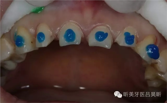 640.webp (65).jpg 640.webp (65).jpg