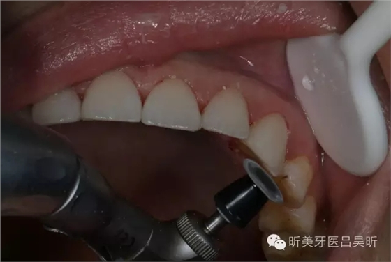 640.webp (79).jpg 640.webp (79).jpg