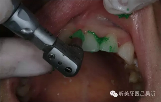 640.webp (81).jpg 640.webp (81).jpg