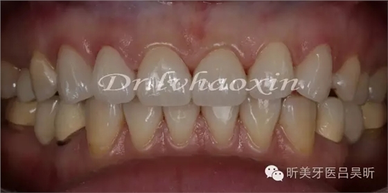 640.webp (82).jpg 640.webp (82).jpg