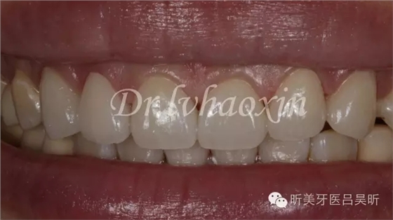 640.webp (83).jpg 640.webp (83).jpg