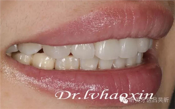 640.webp (84).jpg 640.webp (84).jpg