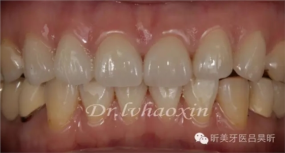 640.webp (85).jpg 640.webp (85).jpg