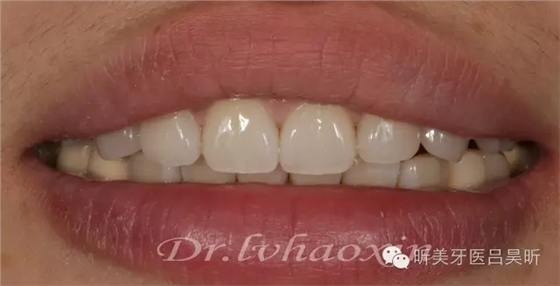 640.webp (86).jpg 640.webp (86).jpg