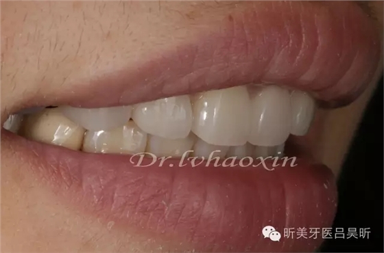 640.webp (87).jpg 640.webp (87).jpg