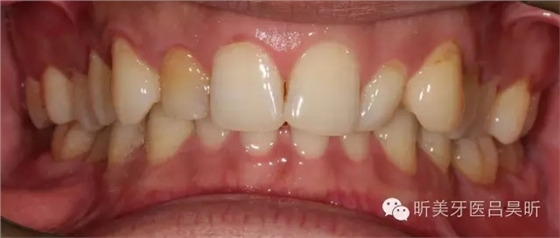 640.webp (1).jpg 640.webp (1).jpg