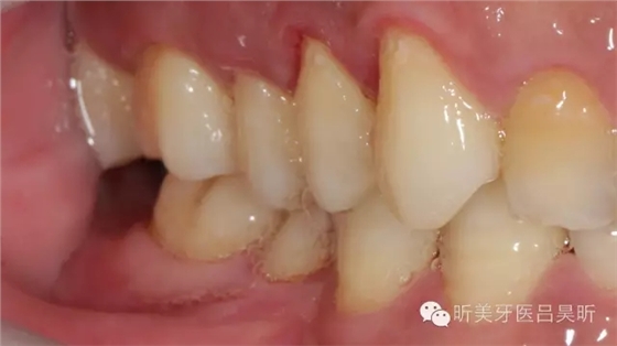 640.webp (2).jpg 640.webp (2).jpg