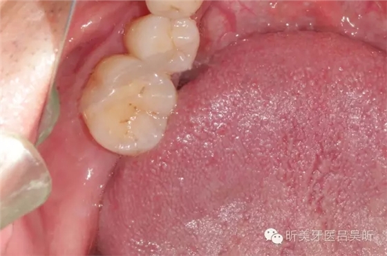 640.webp (3).jpg 640.webp (3).jpg