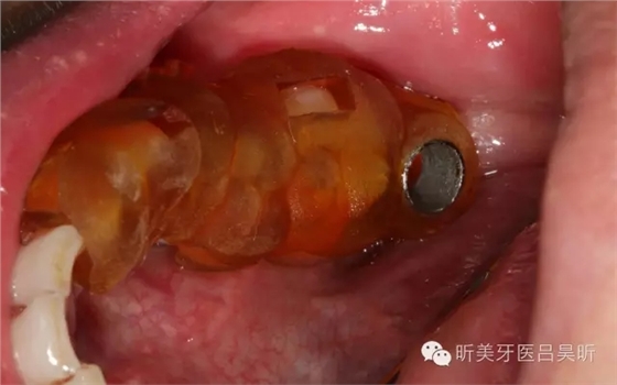 640.webp (26).jpg 640.webp (26).jpg