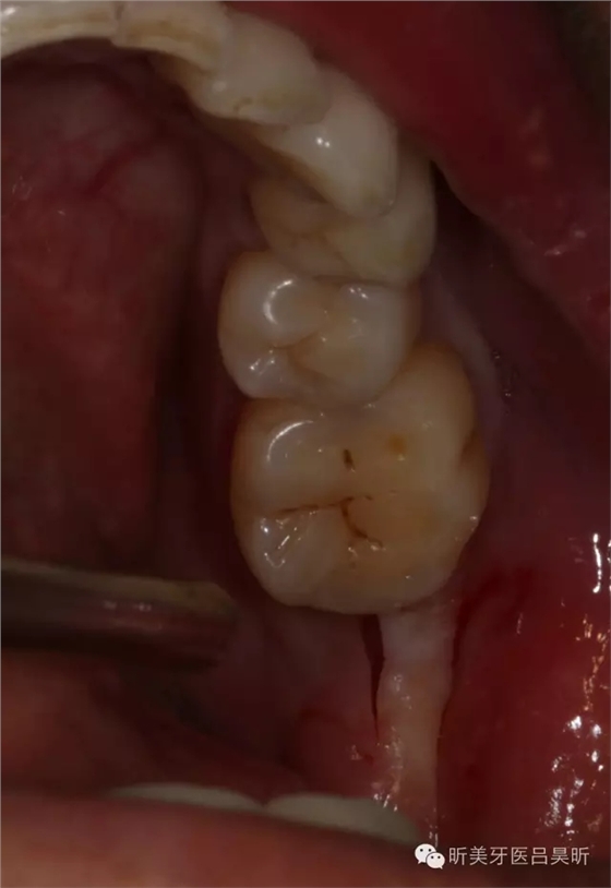 640.webp (28).jpg 640.webp (28).jpg