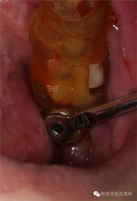 640.webp (30).jpg 640.webp (30).jpg