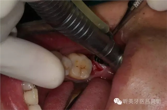 640.webp (32).jpg 640.webp (32).jpg