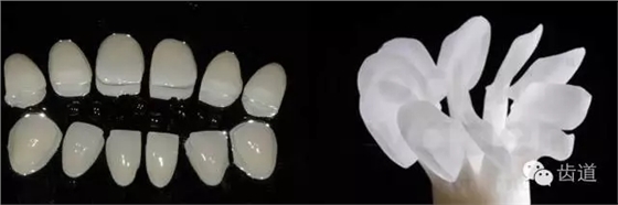 瓷貼面的粘接步驟及技術(shù)要點(diǎn) 瓷貼面的粘接步驟及技術(shù)要點(diǎn)