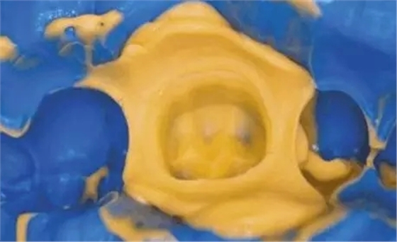 640.webp (3).jpg 640.webp (3).jpg