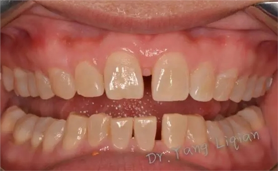 640.webp.jpg 640.webp.jpg