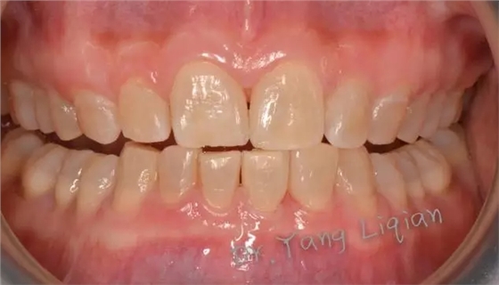 640.webp (11).jpg 640.webp (11).jpg